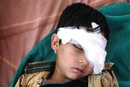 برہان وانی کی شہادت کے بعد مقبوضہ وادی میں 515 کشمیری شہید