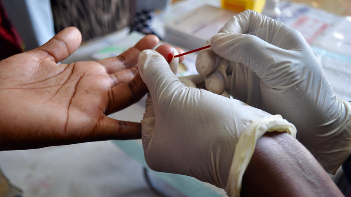 ایڈز HIV کے مریضوں سے پیار