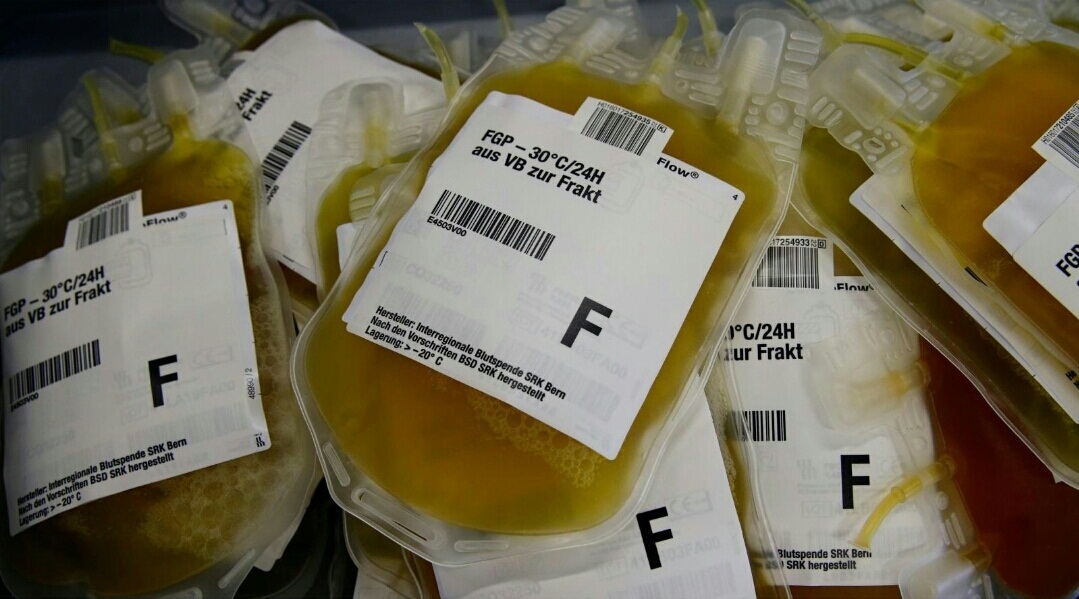 Plasma Therapy