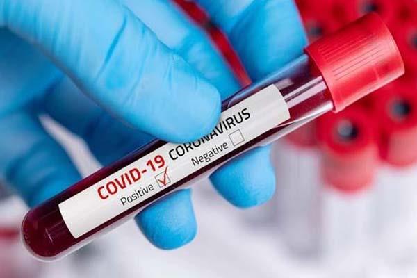 آخر کورونا چاہتا کیا ہے؟