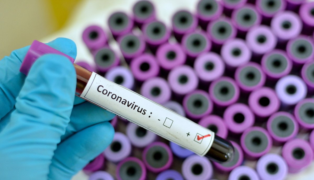 Coronavirus Test