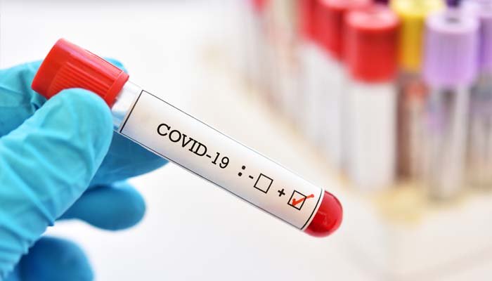 کووڈ 19 صرف سانس یا پھیپھڑوں کی ہی بیماری نہیں: ماہرین