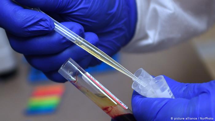 کورونا کے خلاف پہلی ویکسین روس نے بنا لی، صدر پوٹن کا اعلان