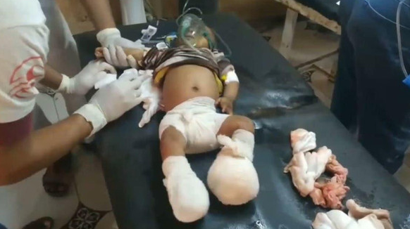 حوثی باغیوں‌ کے ہاتھوں مغربی یمن میں نہتے شہریوں کا قتل عام