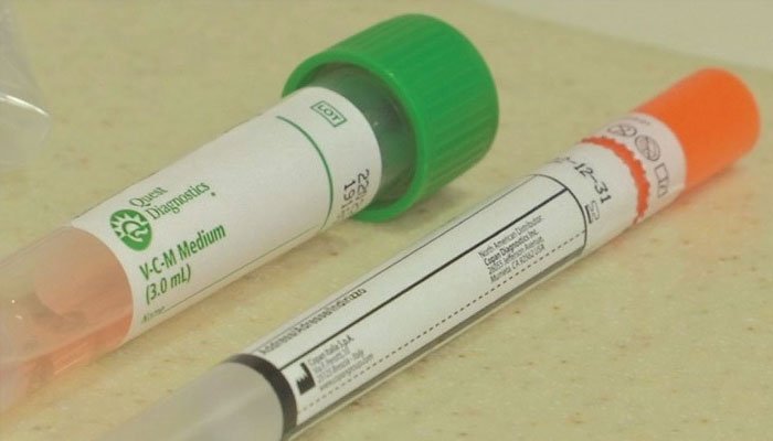 پنجاب میں کورونا ٹیسٹنگ کٹس میں کمی کی شکایات