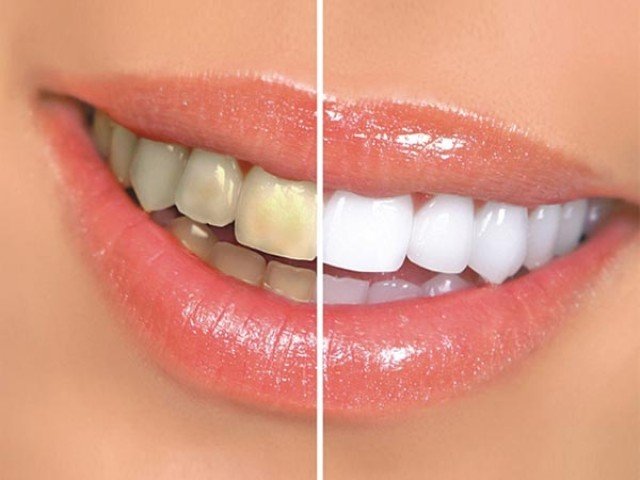 دانتوں کی صفائی ضروری ہے… لیکن کب؟