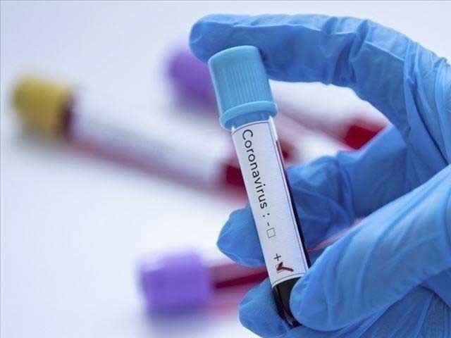 خیبر پختونخوا میں بھارتی اور برطانوی کورونا اقسام کے مزید 21 کیس سامنے آگئے