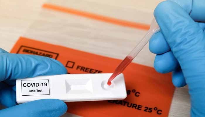 کراچی میں کووڈ ٹیسٹ کا نتیجہ اپنی مرضی سے بنوائے جانے کا انکشاف
