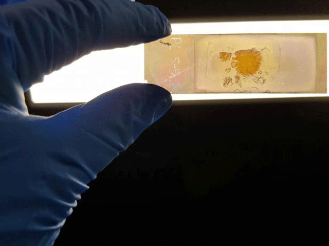 رنگ بدل کر امراض شناخت کرنے والی نینوٹیک پٹی