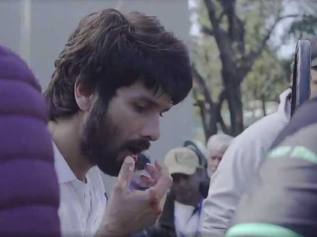 شاہد کپور شوٹنگ کے دوران چہرے پر گیند لگنے سے زخمی، 25 ٹانکے آئے